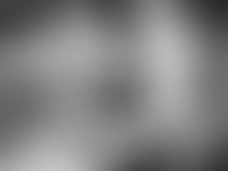 Omissione di diagnosi di spina bifida del feto: Un grave errore medico nei baby case