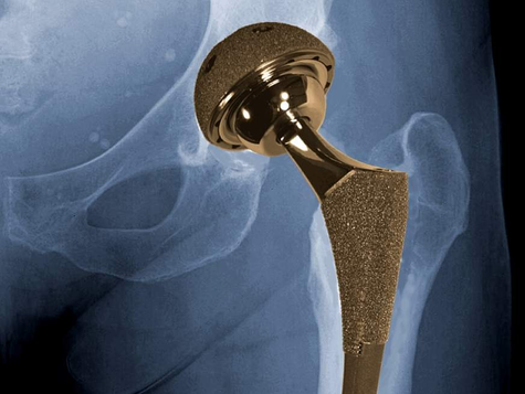 Avaliação Biológica de Dispositivos Médicos.