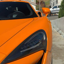 McLaren 570 | Luxury Package Detail |