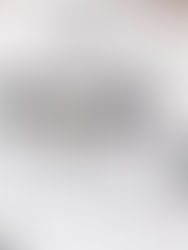 Visual Therapy in Optometric Care: A Treatment for Eye Coordination and Visual Processing Issues