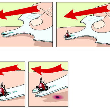 Hoe de tekenkaart werkt