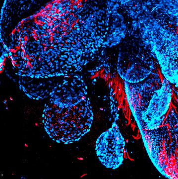 Frontier Bio’s lab-grown lung tissue – a new way for future transplants and respiratory treatments