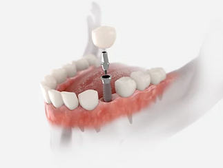 Capture d’écran 2023-07-20 à 12.18.43.png