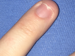 Sunday Inspiration: The Broken Nail