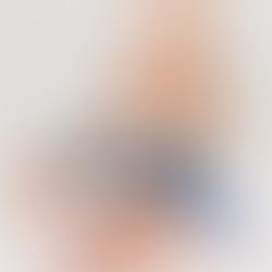 Lääkärin näkökulma: faktaa ja fiktiota botoxista