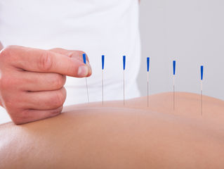 What to Expect During an Acupuncture Visit!