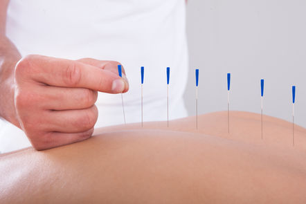 Men are less likely than women to seek acupuncture...