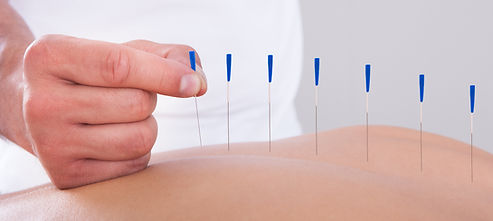 Needle Manipulation