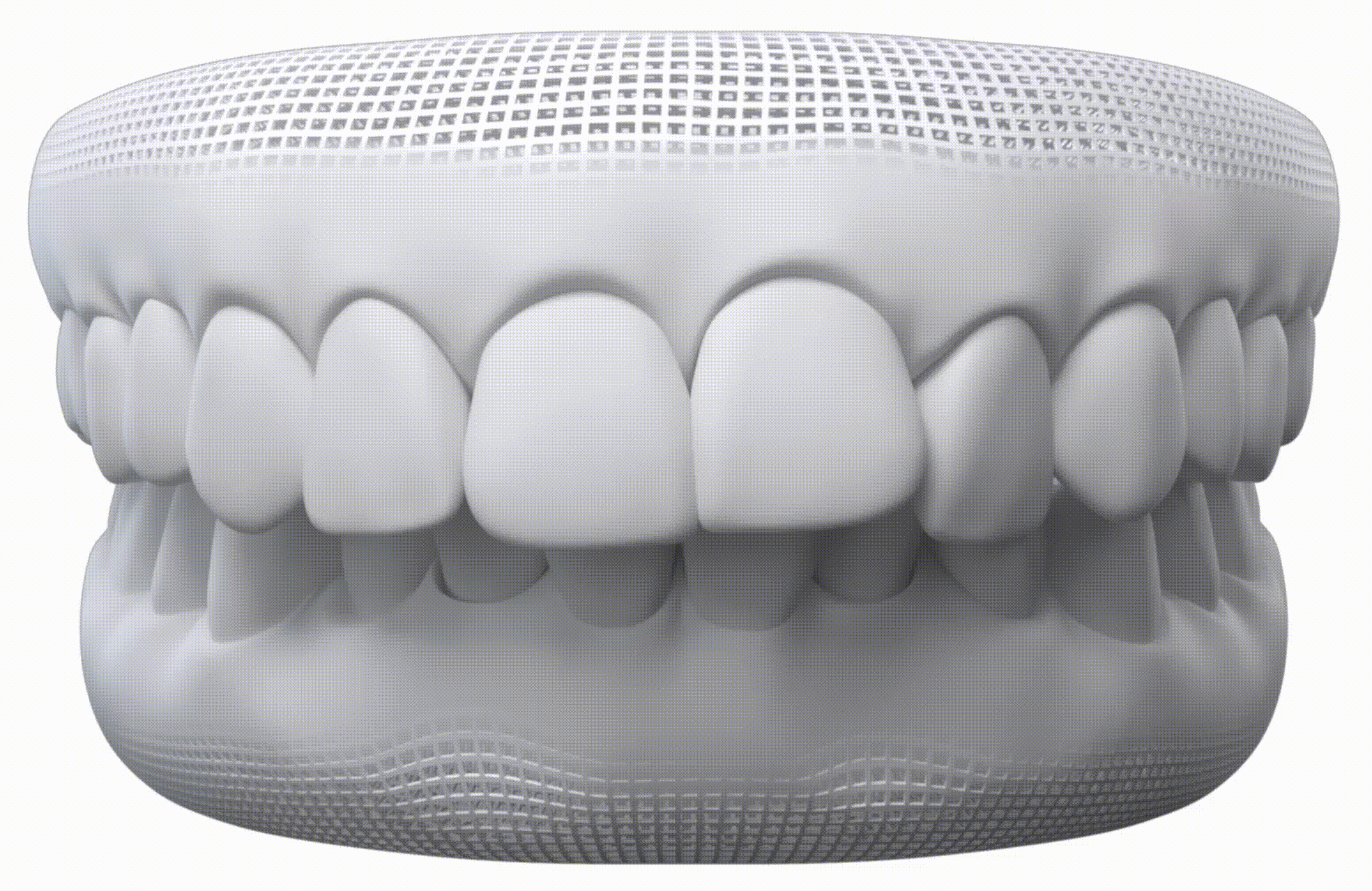 sobremordida-invisalign.gif
