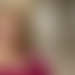 Before and after dental implant results at International Dental Center PV showing patient smile transformations