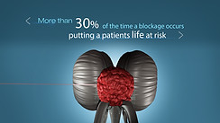 Brain-Closeup1001.jpg
