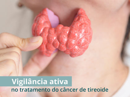 O que é vigilância ativa no câncer de tireoide?