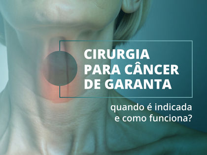 Cirurgia para câncer de garganta: quando é indicada e como funciona?