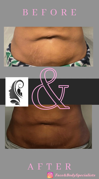 NovaThread Before & After