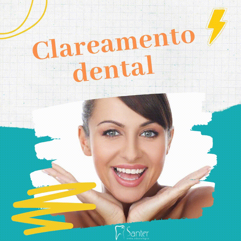 gig.clareaento.gif