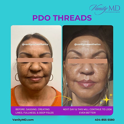 Mo P PDO Threads