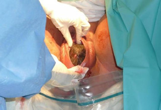 Ejercicios de Kegel