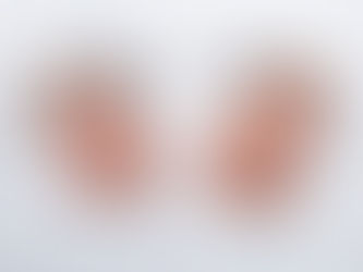 Carolina Physician Assistant Found Guilty Of $10 Million Medicare Fraud Scheme