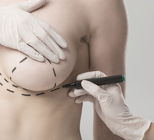 a picture of woman having a breast lift