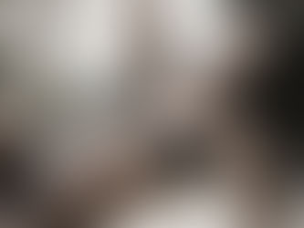 Exploring the Transformative Benefits of Liposuction