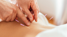 Acupuntura para Dor Lombar: o que a ciência mais recente mostra?