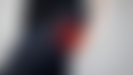 Síndrome do Piriforme é uma das causas da dor ciática – Tire suas dúvidas