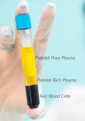 Thumbnail: PRP tubes - individual tubes