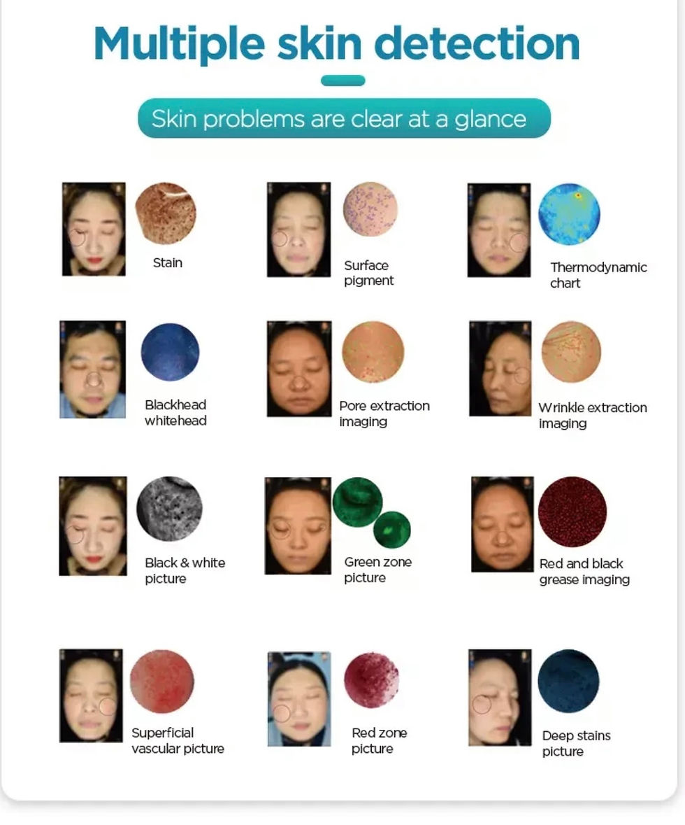 Thumbnail: Skin Analyzer Machine