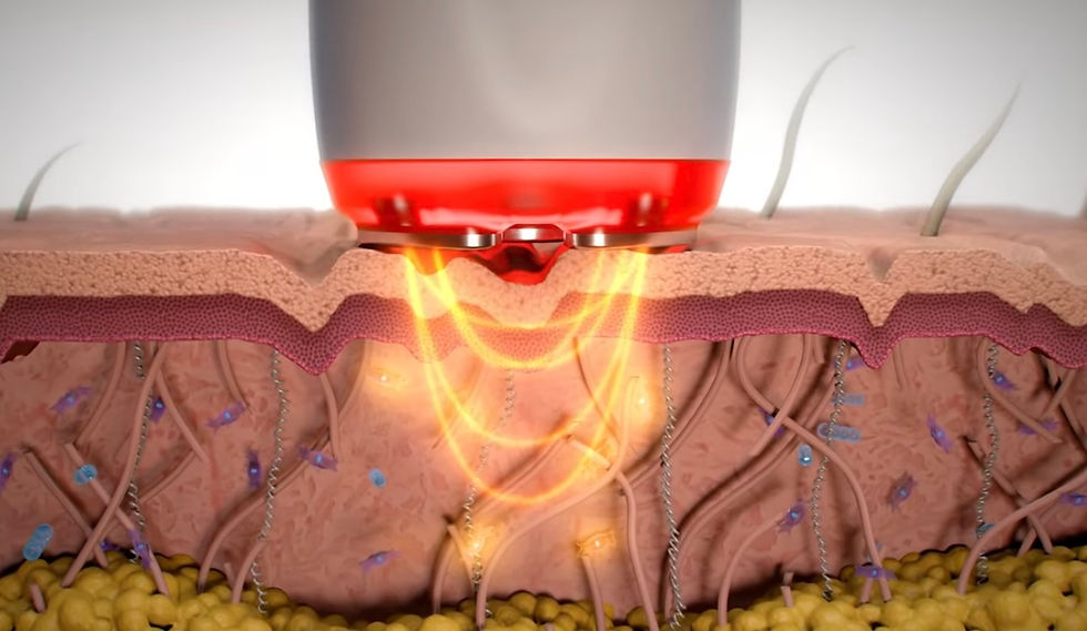 Thumbnail: D COOL ELECTROPORATION 2nd hand
