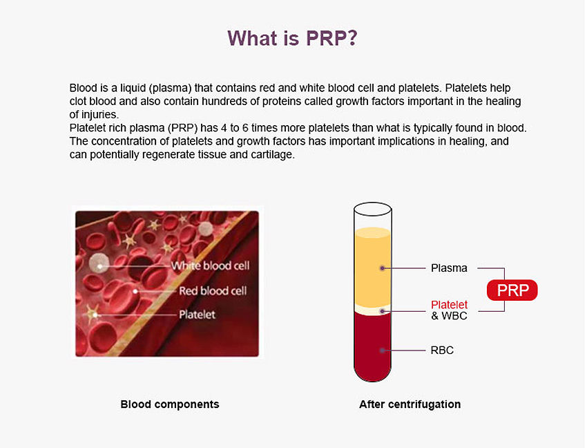 Thumbnail: PRP tubes - individual tubes