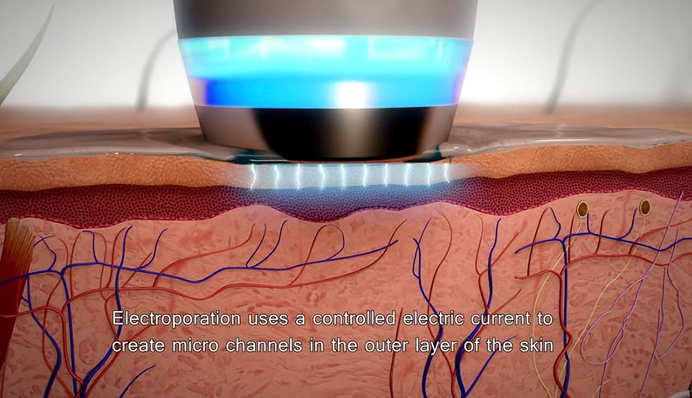 Thumbnail: D COOL ELECTROPORATION 2nd hand