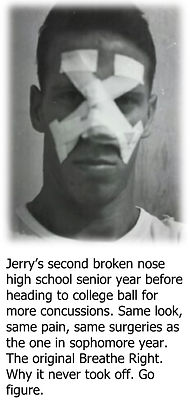 Jerry's broken nose, breathe right 1.jpg