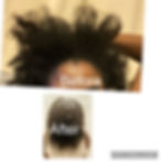 Thumbnail: Before and after after regular use of Nouvel Hair Growth Oil