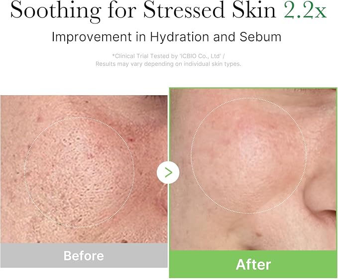 Thumbnail: Medicube Exosome Cica Cream (50 ml)