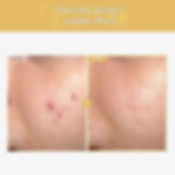 TOSOWOONG Black Snail Ginseng Serum – 1.0 fl oz (30 ml)