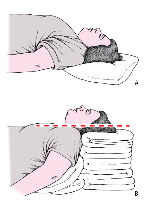 CRC-head-neck-positioning-v2-red-sniffing.gif