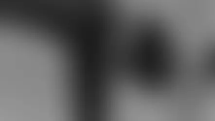 Fascias et Système Lymphatique : une relation cruciale pour votre Santé, votre mobilité et votre énergie. Femme en posture d'équilibre au yoga