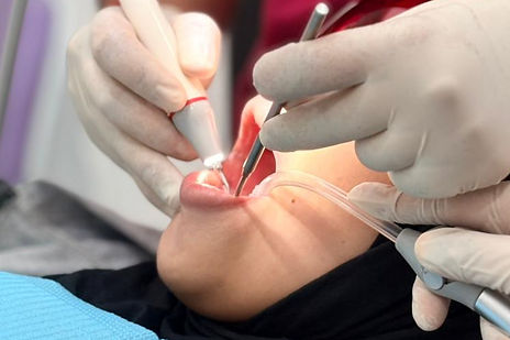 Dentist performing a procedure in a bright clinic. Gloved hands hold dental tools near a patient's open mouth. Blue and red colors visible.