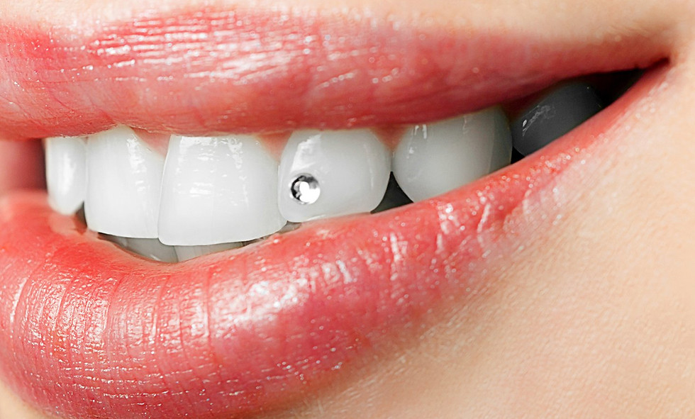 tooth_gems_swarovski_crystal