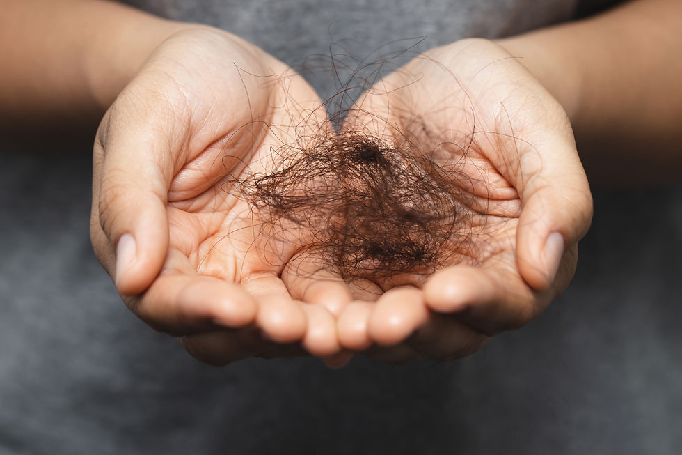 Shedding hair in hands from hair loss