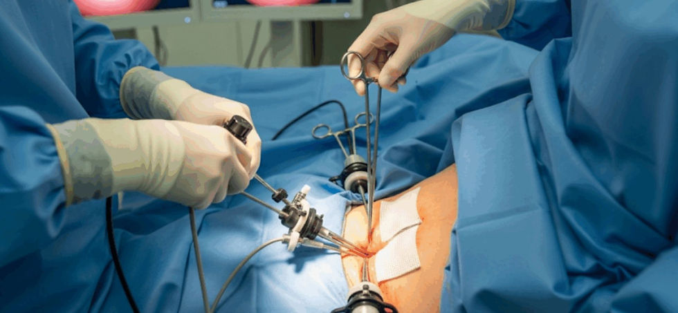hernia.webp