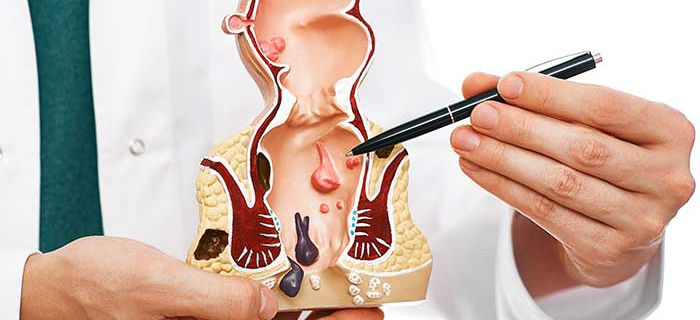 Proctology-1.jpg