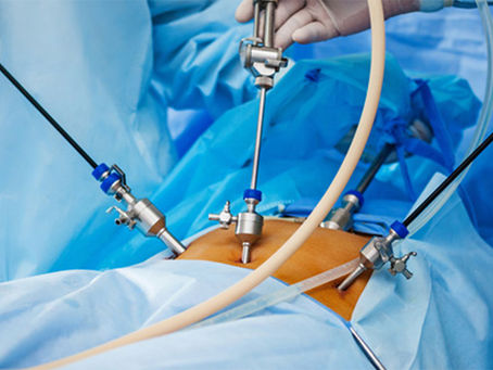 Laparoscopic Surgery in Kolkata