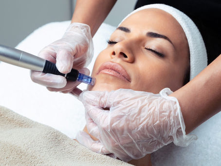 Microneedling Mesotherapy