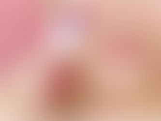 What is microneedling? Benefits and use