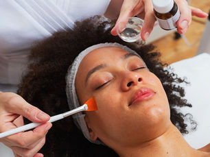How do chemical peels work?