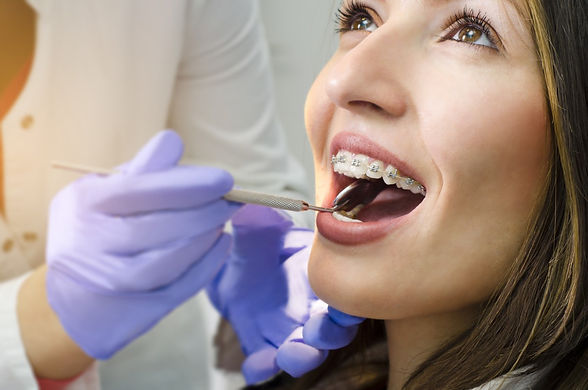 Lincoln-ortho-adult-braces.jpeg