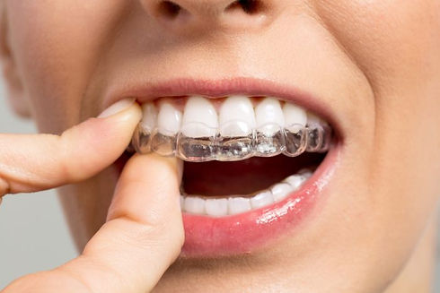 how-invisalign-is-changing-smiles-one-smile-at-a-time_medland-orthodontics_gold-coast-e155