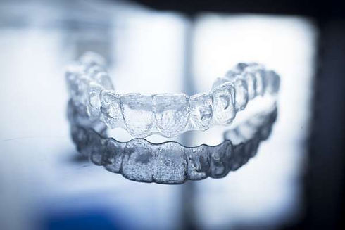 new-braces.jpeg
