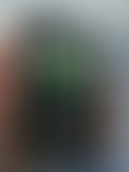 Medtronic 780G review - my honest thoughts 2 years in